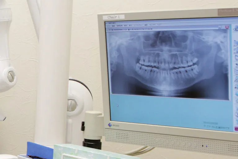 デジタルレントゲン